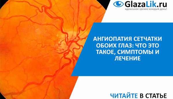 лечение ангиопатии сетчатки глаз